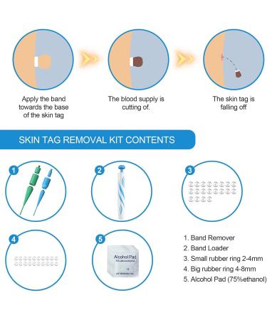 AQSQWQ Skin Tag Treatment Kit Auto Skin Tag Remover Kit Wart Removal Kit 2-8mm 2 in 1 Skin Tag Treatment Kit Suitable for All Body Parts - Buy Online on GoSupps.com