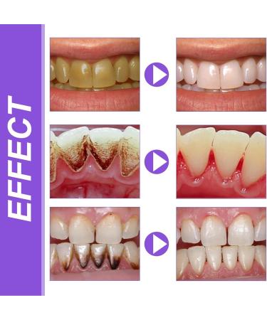 3 Pieces Tooth Whitening Toothpaste Set - Stubborn Spot Treatment Refreshing Breath Brightening Mousse for a Radiant Smile | International Shipping - Buy Online on GoSupps.com