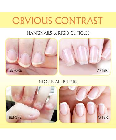 Nailive Organic Milk and Honey Nail Cuticle Oil with Jojoba Essence - 15ml - Buy Online on GoSupps.com