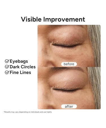In My Eyes Eye Repair Gel Cream - Under Eye Cream with Caffeine & Lutein, Anti-Wrinkle and Firming, Treatment to Reduce Dark Circles, Fine Lines & Puffiness, 0.5 oz. - Buy Online on GoSupps.com