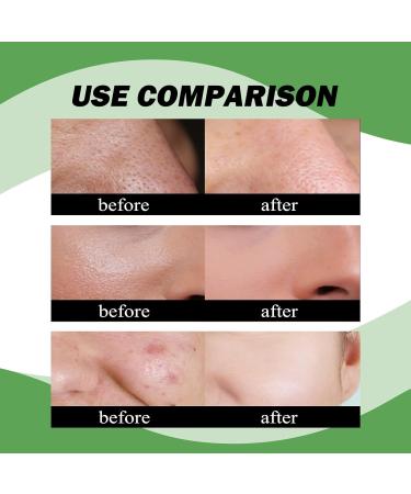Bamboo Charcoal Facial Soap - Oil Control Deep Cleansing & Brightening | Removes Blackheads Unclogs Pores Hydrating(2PCS) - Buy Online on GoSupps.com