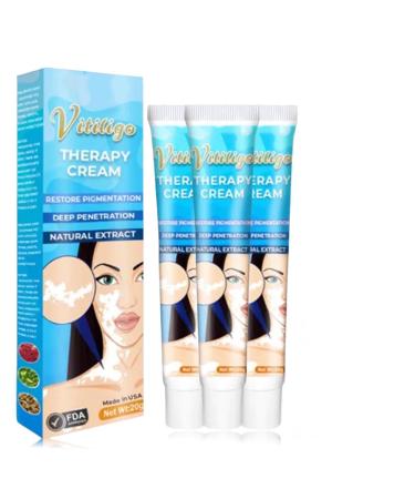 Vitiligo Cream Vitiligo Therapy Cream White Spot Cream Pigmentation regulating Treatment for Skin Vitiligo