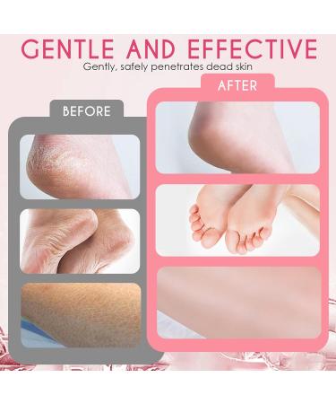 2 Paires Masque Pied Peeling Hornhaut Entfernung Fuß Peeling Maske Hydratantes Pieds Nourrissant pour les Pieds Soin R parateur pour Hommes et Femmes (strawberry + papaya) - Buy Online on GoSupps.com