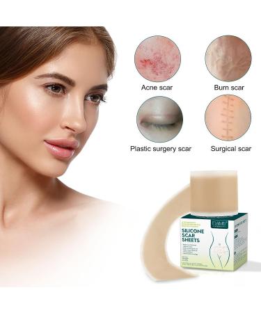Professional Silicone Scar Tape Roll - Reusable Scar Sheets for Surgery, C-Section, and Acne Scars - 8 Month Supply - 1.6 x120 Roll-3M - Buy Online on GoSupps.com