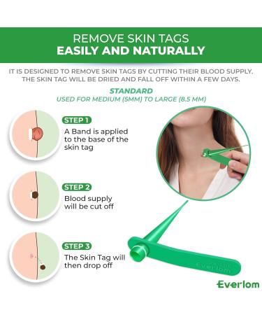 Standard Skin Tag Tool Premier Quality Skin Tag Tool Kit Fast and Easy Get Rid of Skin Tags Painless Skin Tag Tool Kit for Medium (5mm) to Large (8.5mm) Skin Tags - Safe for Most Parts - Buy Online on GoSupps.com
