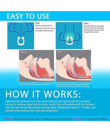 Snore Stopper Set - Comfortable Anti Snoring Nose Vents for Men and Women - Silicone Magnetic Nose Clip - Effective Snoring Solution - Nasal Dilator (12 Pack) - Buy Online on GoSupps.com