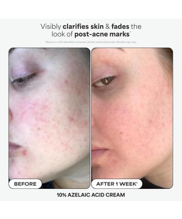 Paula's Choice Complexion Clarity Kit 3 Piece Set Includes Full-Sized 2% BHA Exfoliant 1% Retinol Treatment Full-Sized 10% Azelaic Acid Booster Skin Care Set for Clear Glowing Skin - Buy Online on GoSupps.com