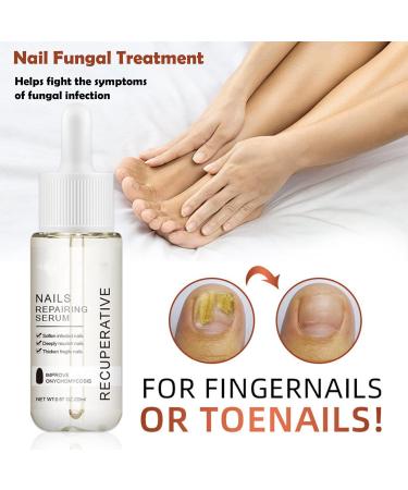 Nail Growth and Strengthening Serum 20ml Nails Repair Serum Fungal Nail Treatment for Toenail Extra Strong Toenail Growth Treatment for Repairing Damaged and Discolored Nails Improve Onychomycosis - Buy Online on GoSupps.com