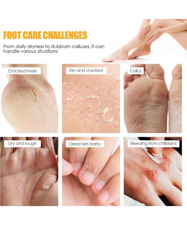 Wvu Wvo Moisturizing and anticracking foot cream moisturizing and anticracking foot cream foot care cream relieves extreme dryness and cracking of the feet - Buy Online on GoSupps.com