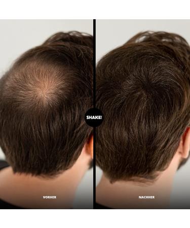 Shake Over Vegan Scatter Hair Compression - Zinc Enriched Fibers High-Quality Bulk Hair Made in Europe (12g Ash Blonde) - Eco-Friendly Hair Solution - Buy Online on GoSupps.com