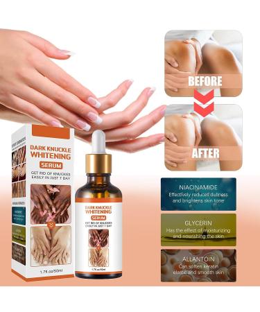 Dark Knuckle Whitening Serum 1.7 Fl Oz - Repair Melanin, Lighten Skin & Remove Darkening - Body Bleaching for Knuckle Elbows - Buy Online on GoSupps.com