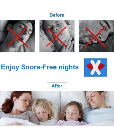 Gentle Mouth Tape for Sleeping (120 Pcs) Stop Snoring Mouth Strips for Men and Women - Buy Online on GoSupps.com