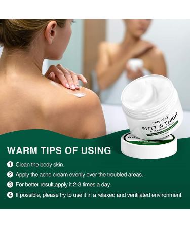 Acne Treatment Cream for Butt & Thigh - Removes Pimples, Ingrown Hairs - Spot & Cystic Acne Treatment - Moisturizes and Repairs Skin - Buy Online on GoSupps.com