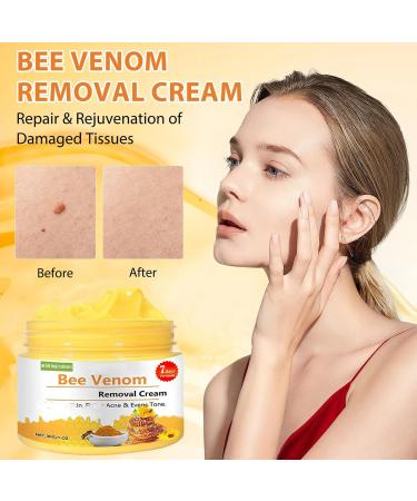 Buy Professional Bee Venom Cream & Gel for All Skin Types | Repair & Correct | International Shipping - Buy Online on GoSupps.com