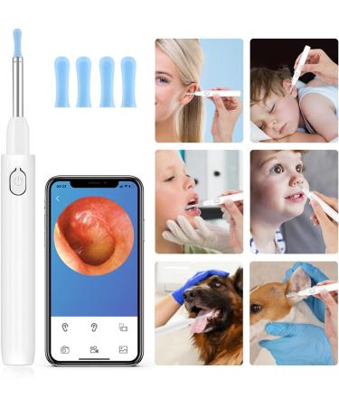Wireless Visual Silicone Ear Spoon Endoscope | Ear Wax Remover & Otoscope | Luminous Camera | Ear Cleaning Tools - Buy Online on GoSupps.com