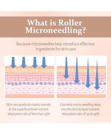 Jurcicat Dermaroller for Beard Growth & Facial Skin Care - 540 Needles Microneedling Roller for Anti-Aging & Scarring (0.5mm) - Buy Online on GoSupps.com