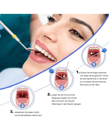 Effective Tonsil Stone Remover Tool - TOONSILLENSTEIN Borosilicate Glass with Tooth Mirror for Easy Almond Stone Removal - Ship Worldwide - Buy Online on GoSupps.com