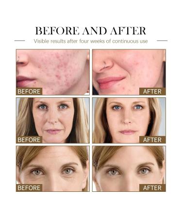 Lilinas Castor Oil Serum - Anti-Aging Face Oil with Black Seed & Rosehip Oil for Wrinkle Reduction & Skin Tightening (1oz - Buy Online on GoSupps.com