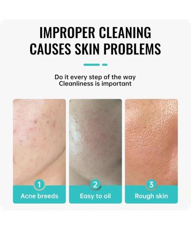 Anti Acne Face Cream Spot Cream for Acne Spot and Acne Treatment for Face and Body Prevent Breakouts and Promote Rapid Recovery Moisturizing Skin Rejuvenation Water-Oil Balance Reduce Redness - Buy Online on GoSupps.com