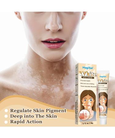  MagiSel Cream to repair white spots and pigmentation disorders hypoallergenic skin cream and pigment gel for skin with white spot disease promotes an even skin tone. - Buy Online on GoSupps.com