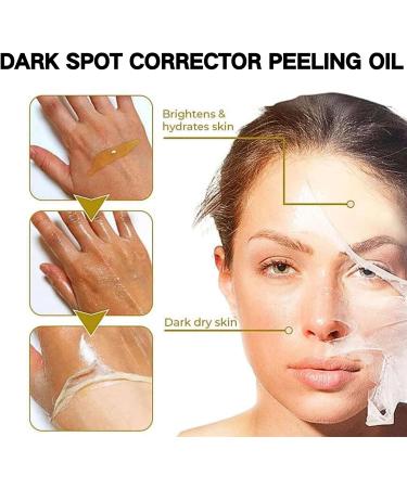 Exfoliating Acanthosis Peeling Oil Exfoliation Body Oil Peeling Solution Skin Peel Dark Spot Corrector Oil Yellow Peeling Oil Body Skin Care Exfoliation Oil Dark Spot Remover For Body Hand Feet - Buy Online on GoSupps.com