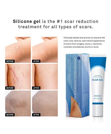 Aroamas Scar Gel - Professional Grade Advanced Scar Removal Treatment 1.06 oz - Buy Online on GoSupps.com