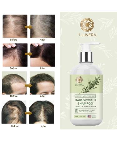 Hair Growth Shampoo | Anti-Hair Loss Solution for Men & Women | Rosemary Mint & Tea Tree Oil | 11.8 fl. oz - Buy Online on GoSupps.com