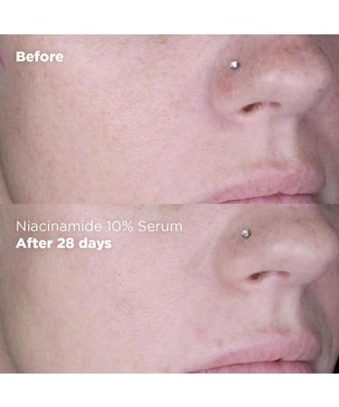 Skin Republic Niacinamide 10% + Zinc 1% Brightening Serum Minimises Excess Oil Pigmentation & Uneven Skin Tone (30ml) - Buy Online on GoSupps.com