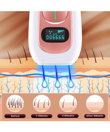 IPL Hair Removal Device | New Upgraded 999,900 Flashes | Permanent Laser Hair Removal for Women and Men | At-Home Use on Facial, Legs, Arms, Armpits, Body - Buy Online on GoSupps.com