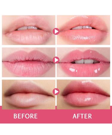 24H Lip Mask Set Strawberry Day & Coconut Night Care Hydrating & Softening Lip Sleeping Mask Duo for Dry Flaky Lips 10g x 2 (Strawberry and Coconut Set) - Buy Online on GoSupps.com