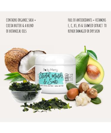 Body Merry Stretch Marks & Scars Defense Cream - Organic Cocoa Butter & Shea Daily Moisturizer - Fade Old & New Marks, Nourish Skin - Pregnancy Belly Cream - 4 oz - Buy Online on GoSupps.com