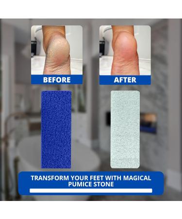 Love Natural Pumice Stone for Feet - 2-in-1 Exfoliating Scrubber for Dead Skin & Callus Removal - Professional Foot Care Rock (Blue - Buy Online on GoSupps.com