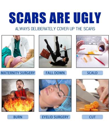 HEXILIN Gentle Scar Removal Cream for All Skin Types - Skin Repair and Diminish Scars, One Size - Buy Online on GoSupps.com