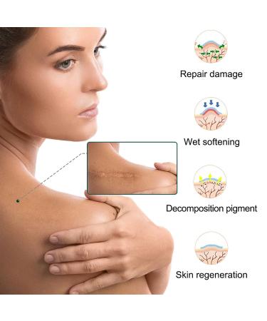 Silicone Scar Patch Roll - Professional Scar Removal Tape for Surgery, Burns, Keloid - 1.6 x 120 Roll - Buy Online on GoSupps.com
