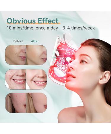 SAKOTISO LED Face Mask - 7 Color Light Therapy for Skin Care | Infrared & Blue Red Light Facial Treatment Black - Buy Online on GoSupps.com