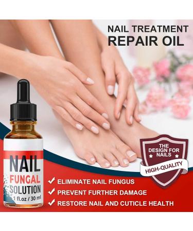 WERPOWER Extra Strong Fungal Nail Treatment for Discoloured Toenails - Effective Relief for Damaged and Infected Nails - Buy Online on GoSupps.com