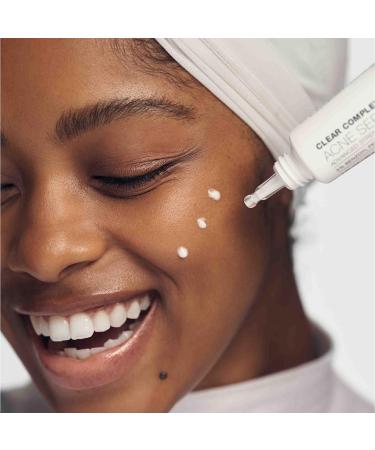 Urban Skin Rx Clear Complexion Acne Serum + Spot Treatment | 5% Benzoyl Peroxide & 5% Glycolic Acid | 1 fl oz - Buy Online on GoSupps.com