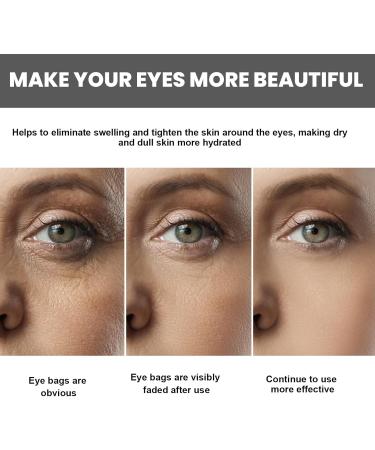 Vitamin C Eye Cream Stick Glow Vitamin C Eye Balm Eye Cream Anti Aging Eye Cream for Dark Circles and Puffy Eyes Cooling & Hydrating Eye Bags Remover Anti Wrinkle Eye Cream Eye Care Products - Buy Online on GoSupps.com
