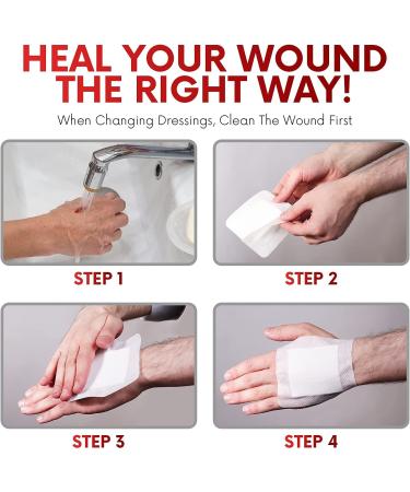HEALQU Bordered Gauze Island Dressing - 30 Count | Sterile 4x4 Gauze Pads with Water-Resistant Backing | Soft and Breathable Wound Dressing - First Aid and Medical - Buy Online on GoSupps.com