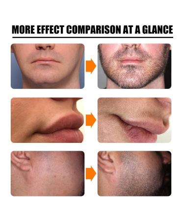 Beard Growth Set for Men | Activator Oil Serum & Care Tools for Thicker Beards - Buy Online on GoSupps.com