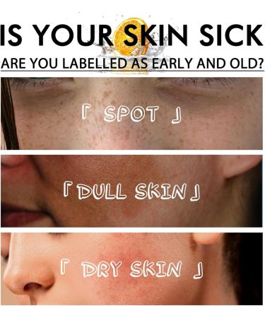 Vitamin C Toner Face Toner For Acne Vitamin C Face Serum Skincare Gifts for Teenage Girl Pore Minimizer Serum Brightening Niacinamide Serum for Anti Aging Reduce Dark Spots&Dullness Nourishing For Dry - Buy Online on GoSupps.com