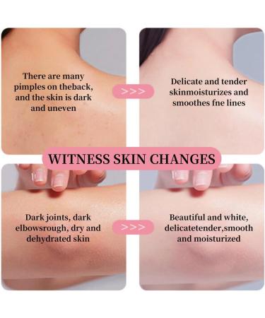 Rose Body Butter for Women - Body Butter for Dry Skin - Natural Moisturiser - Rose Body Moisturiser for Hydrating Nourishing Firming - Skin Care Rose Butter Moisturiser - Softens and Smooths Skin - Buy Online on GoSupps.com