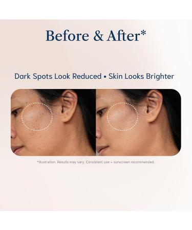 Dark Spot Remover for Face Niacinamide Tranexamic Acid Dark Spot Corrector & Melasma Face Serum 30ml /1 fl.oz - Buy Online on GoSupps.com