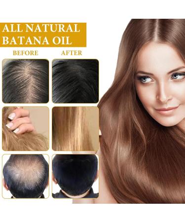 Batana Oil 2 Pack Organic Natural Batana Oil for Hair Growth Improves Natural Hair Growth Prevents Hair Loss and Split Ends Suitable for All Hair Types - Buy Online on GoSupps.com