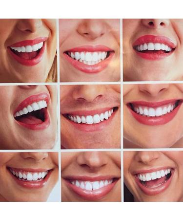 YTXY Instant Cosmetic Teeth - 2 Pairs of Temporary Dental Veneers for Whitening & Denture Cover - Buy Online on GoSupps.com