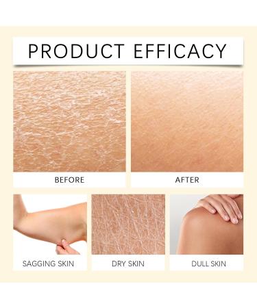 VKaoess Turmeric Vitamin C Body Lotion Brightening and Firming Moisturizer for Face and Body Helps Even Out Skin and Remove the Appearance of Skin 5 Bottles - Buy Online on GoSupps.com