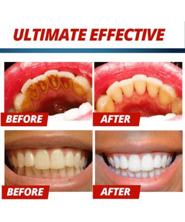 Dinglong Baking Soda Toothpaste - Stain Removal Whitening Toothpaste Fight Bleeding Gums Toothpaste 225g (Purple) - Buy Online on GoSupps.com