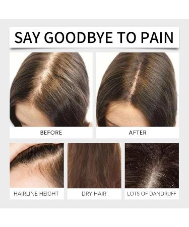 QPJUVC Rosemary hair growth serum nourishing hair oil for scalp care repairs dry and damaged hair counteracts frizz and prevents hair loss 4 - Buy Online on GoSupps.com