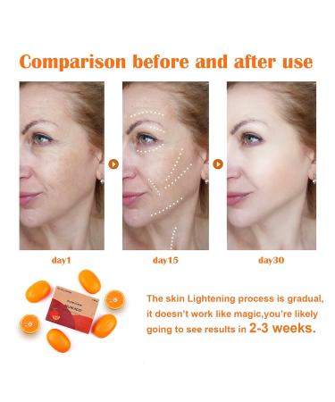 Poleview Kojic Acid Skin Lightening Soap - 2 Bars, 100g - Brightens Skin, Evens Tone, Reduces Hyperpigmentation - Buy Online on GoSupps.com