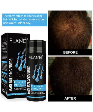 Natural Hair Fiber Powder for Men & Women - Dark Brown - Thickens Hair & Conceals Hair Loss - International Shipping Available - Buy Online on GoSupps.com